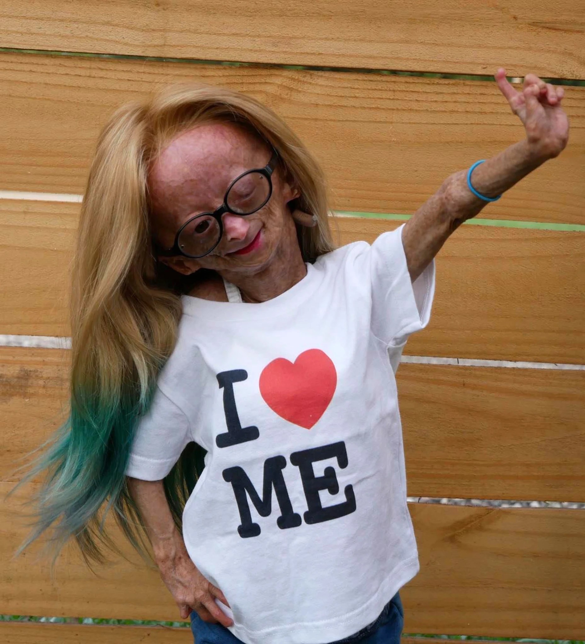 Adalia Rose Williams dies