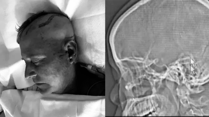 Bob Saget death mystery